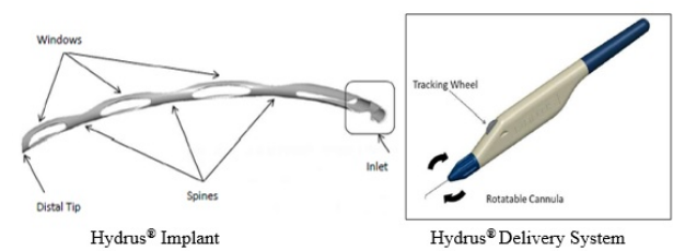 Hydrus ® Microstent